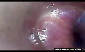 endoscopio per provetta con rubinetto POV, asta sferica per inserimento uretrale